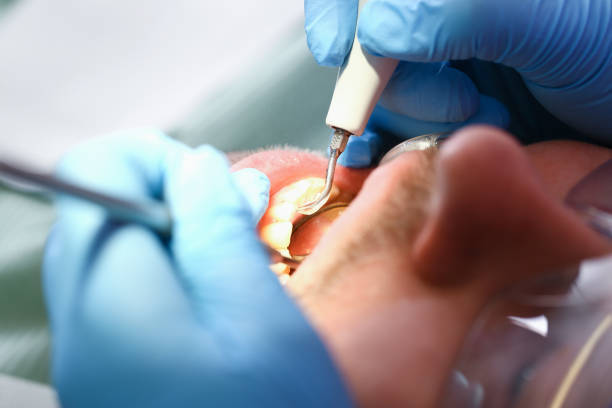Best Urgent Dental Care for Toothache in Dekal, IL